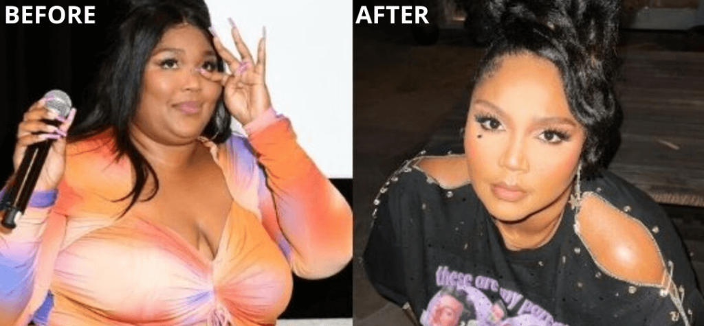 Lizzo before and after pictuires