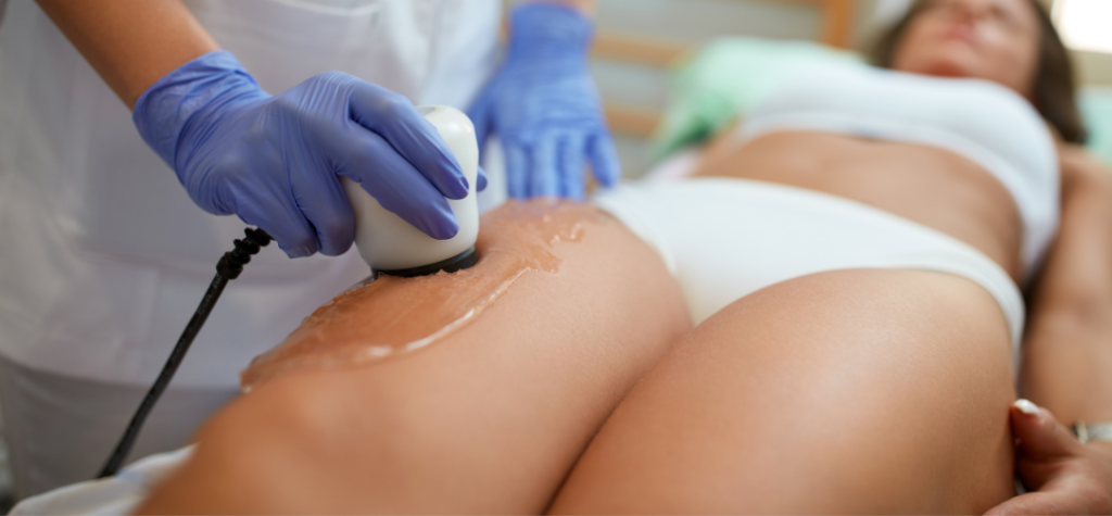 Risks and side effects of cellulite treatments